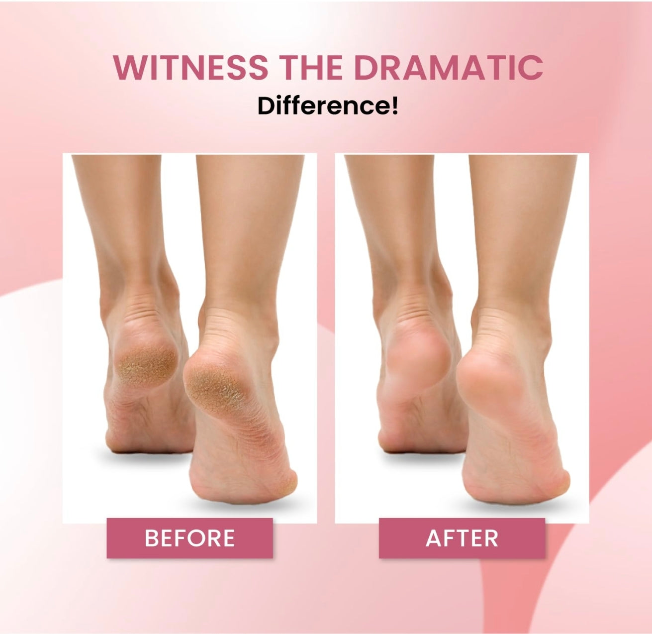 Urban Yog Electric Callus Remover for Feet – Rechargeable Foot File with Powerful Motor & 3 Roller Heads, Painless Pedicure Tool for Smooth, Soft Feet at Home